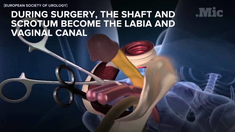 UNESCO Decide: Chiloți pe Nudurile din Marmură